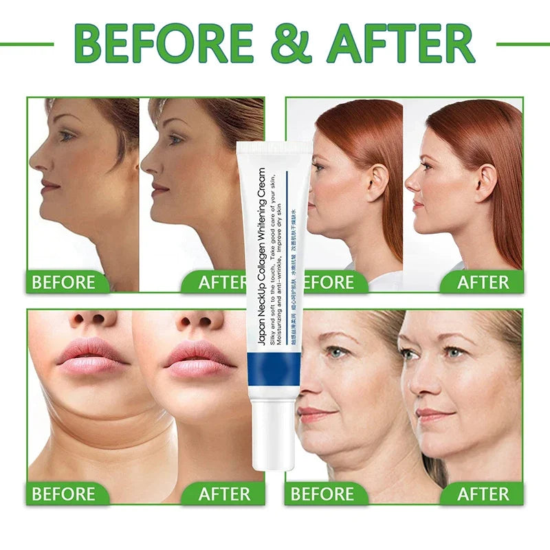 Collagen Anti-aging Neck Cream Reducer Fine Lines Whitening Moisturizing Tightening Lifting For Neck Double Chin Skin Care