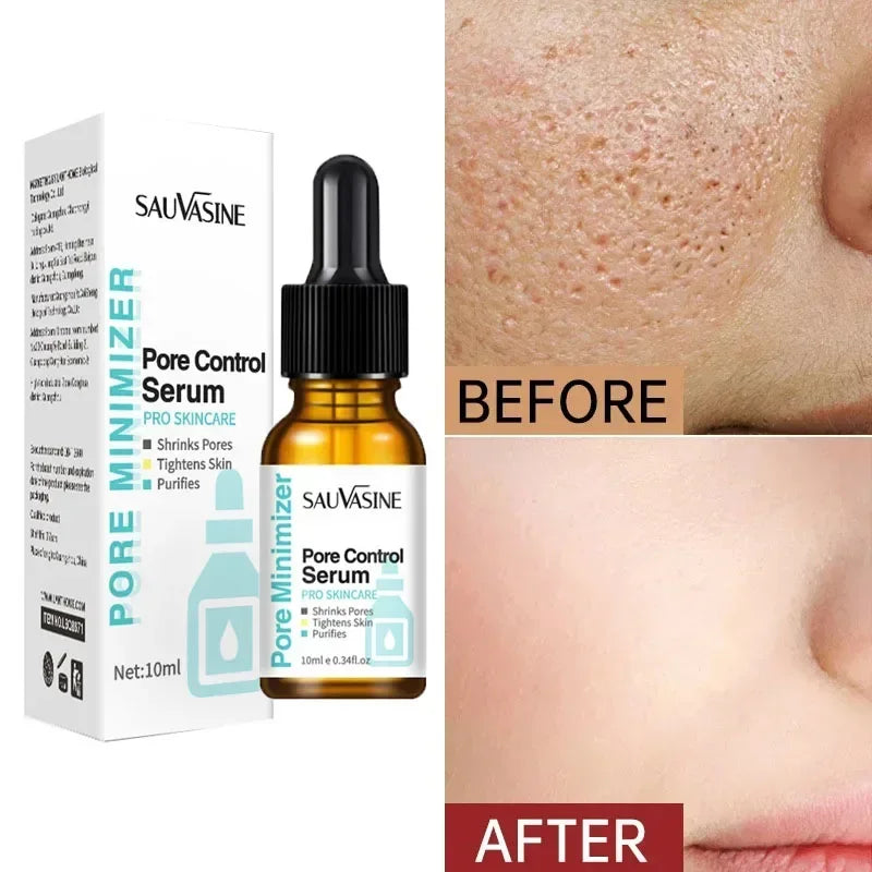 Pore Shrinking Face Serum Remover Blackheads Dark Spots Acne Treatment Oil Control Moisturizing Improve Dull Smoothing Skin Care