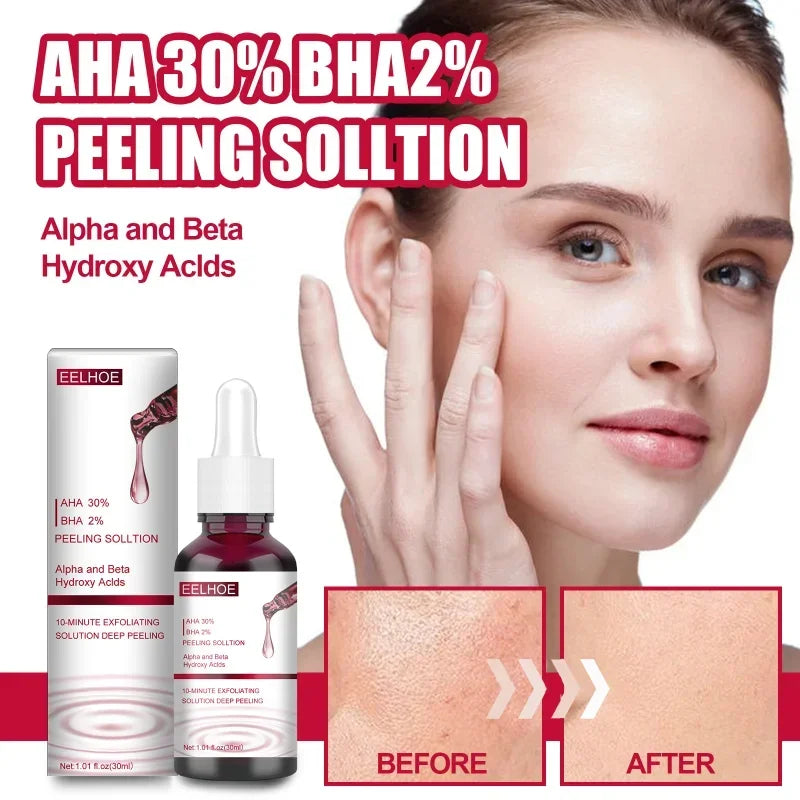 AHA 30% + BHA 2% Salicylic Acid Essence Face Shrink Pore Removes Horny Closed Blackhead Anti Acne Essence Facial Skin Care Serum