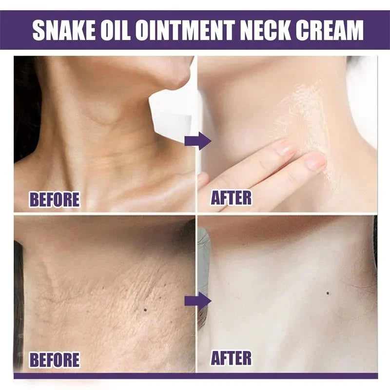 Anti-aging Neck Cream Stick Tightens Lifts Neck Skin Eliminate Double Chin Reduce Neck Fine Lines Moisturizing Nourish Skin Care