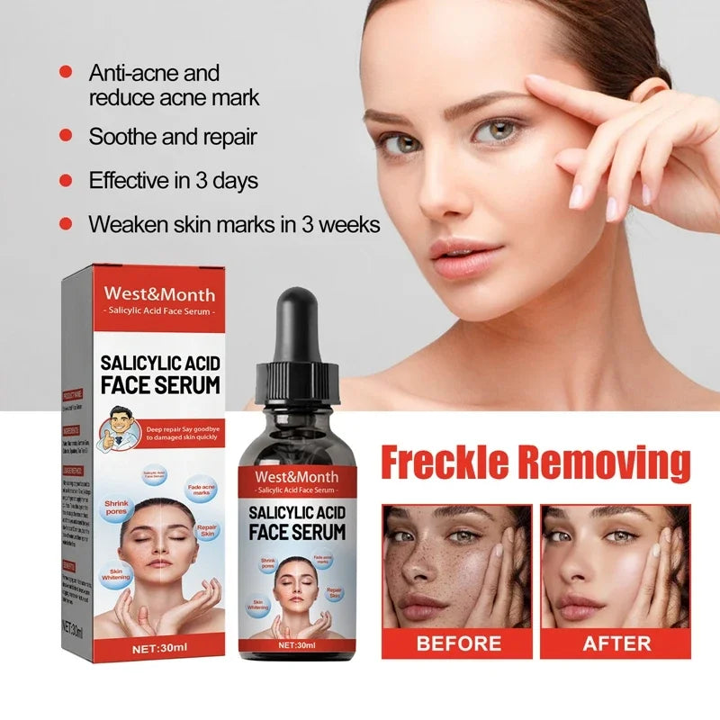 Nicotinamide Attenuates Stains Facial Serum Salicylic Acid Shrinks Pores Freckle Removal Moisturizes Face Skin Care Serum 2024