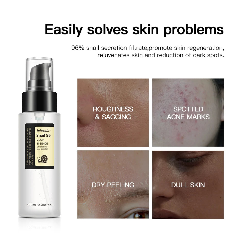 Snail Mucin 96% Power Repairing Essence Hydrating Serum for Face with Snail Secretion Filtrate for Dull & Damaged Skin