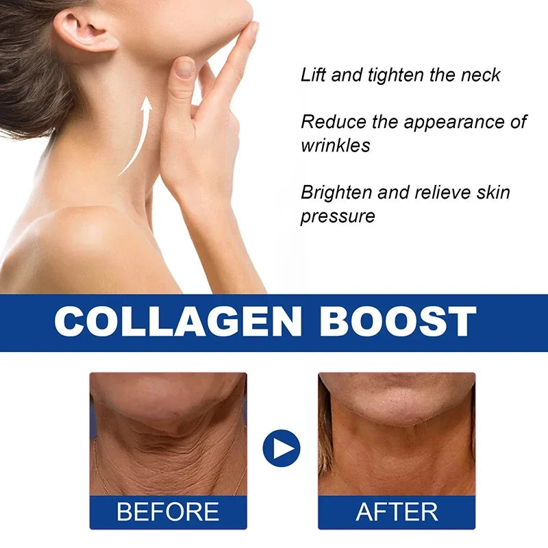 Collagen Anti-aging Neck Cream Reducer Fine Lines Whitening Moisturizing Tightening Lifting For Neck Double Chin Skin Care