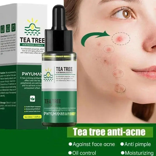 Tea Tree Acne Removal Serum Repair Pimple Spots Shrinking Pore Remove Blackheads Facial Cleaning Fade Acne Marks Whitening Skin