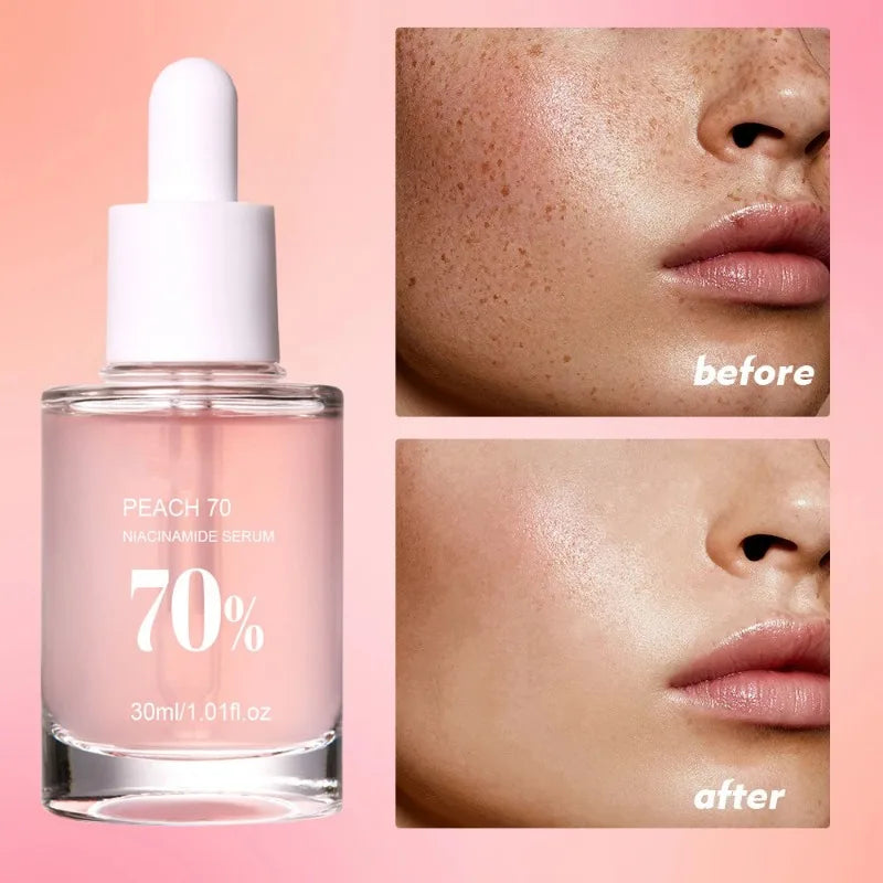 Peach Niacinamide Essence Fade Fine Lines Facial Serum Women Moisturize Brighten Face Serum Fade Dull Melasma Lighten Skin Care