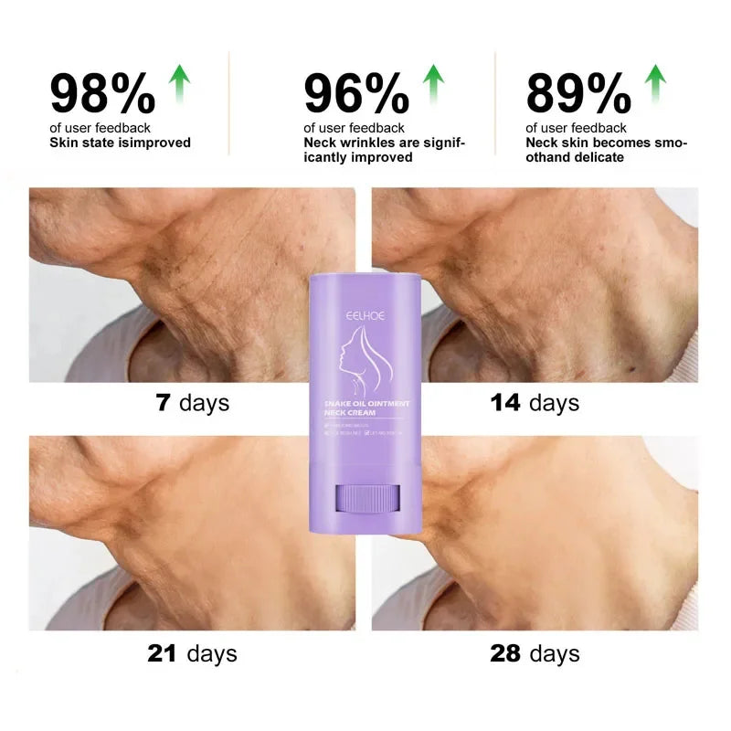 Anti-aging Neck Cream Stick Tightens Lifts Neck Skin Eliminate Double Chin Reduce Neck Fine Lines Moisturizing Nourish Skin Care