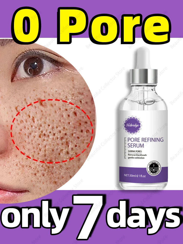 Solve big pores problems