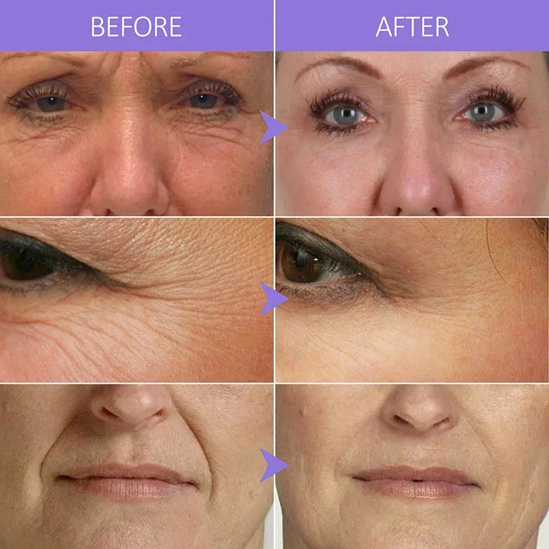 Anti Aging Skin Care Collagen Face Serum Wrinkle Removal Hyaluronic Acid Forehead Fine Lines Lifting Repair Facial Serum