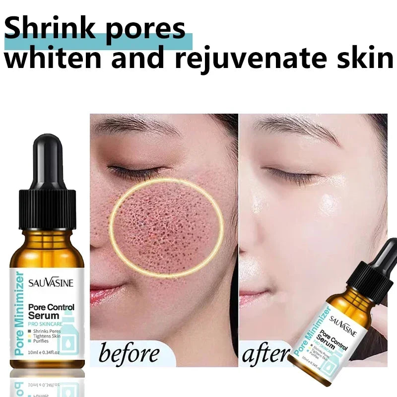 Pore Shrinking Face Serum Remover Blackheads Dark Spots Acne Treatment Oil Control Moisturizing Improve Dull Smoothing Skin Care