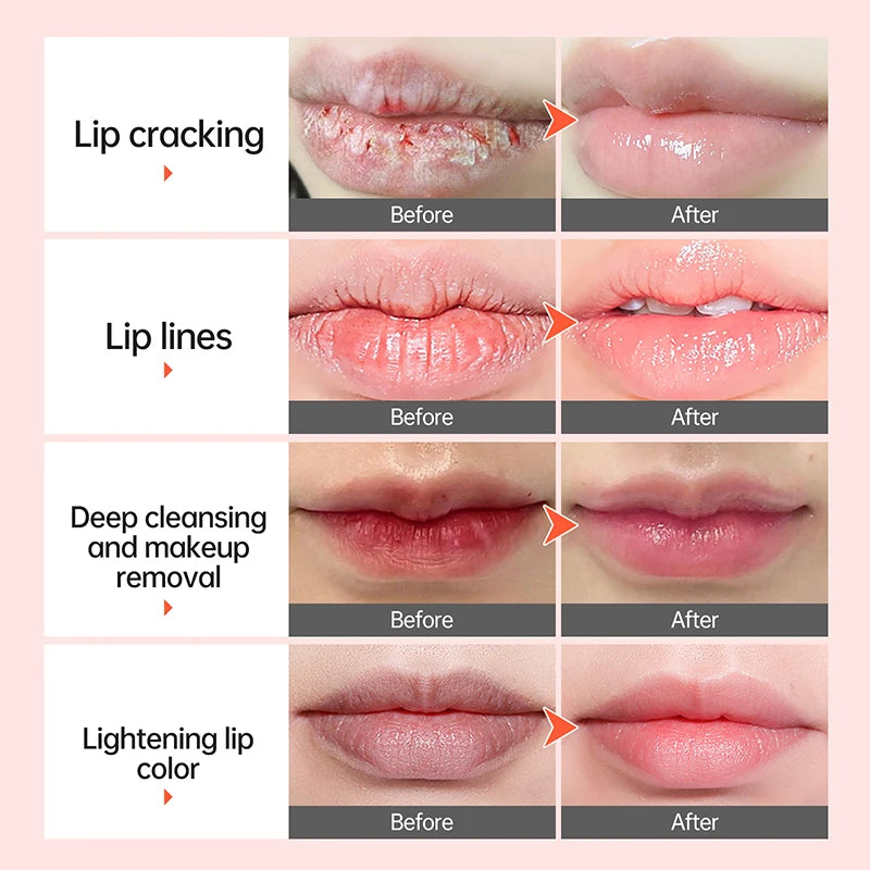 Bubble Lip Mask Balm Exfoliating Oil Makeup Lightening Dark Whitening Moisturizing Remove Dead Skin for Women Volumizer Lip Care