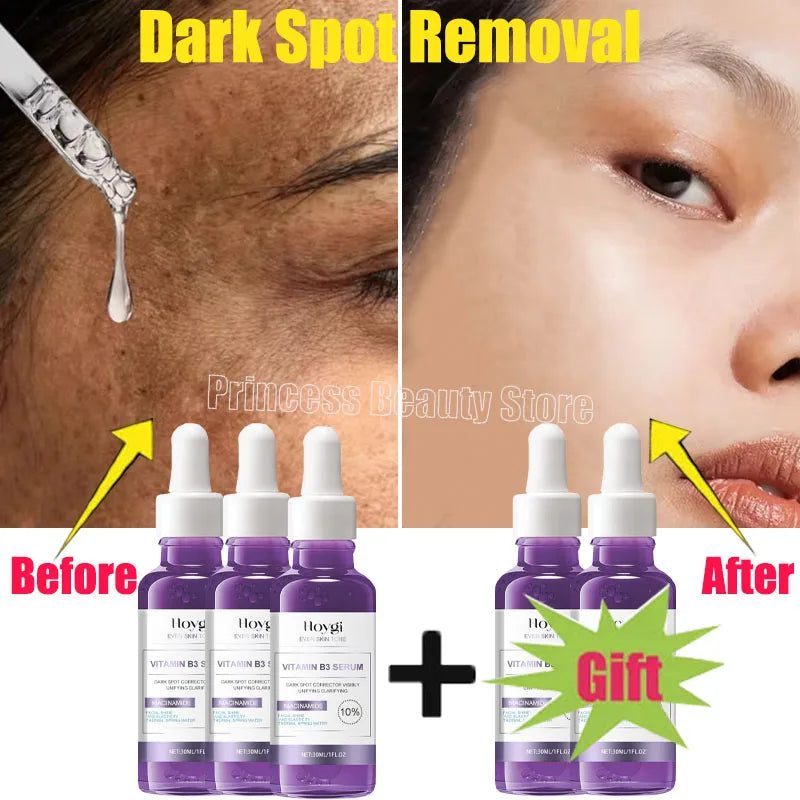 Dark Spots Remover Whitening Serum Face Freckle Melanin Correcting Anti Pigmentation Brighten Beauty Korean Day Night Skin Care