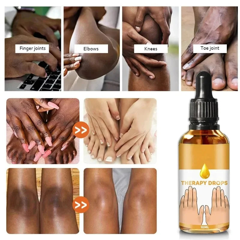 Dark Knuckles Fast Brighten Serum Elbows Hand Knuckle Brightening Serum Knee Black Skin Quickly Lighten Stains Remover Essence