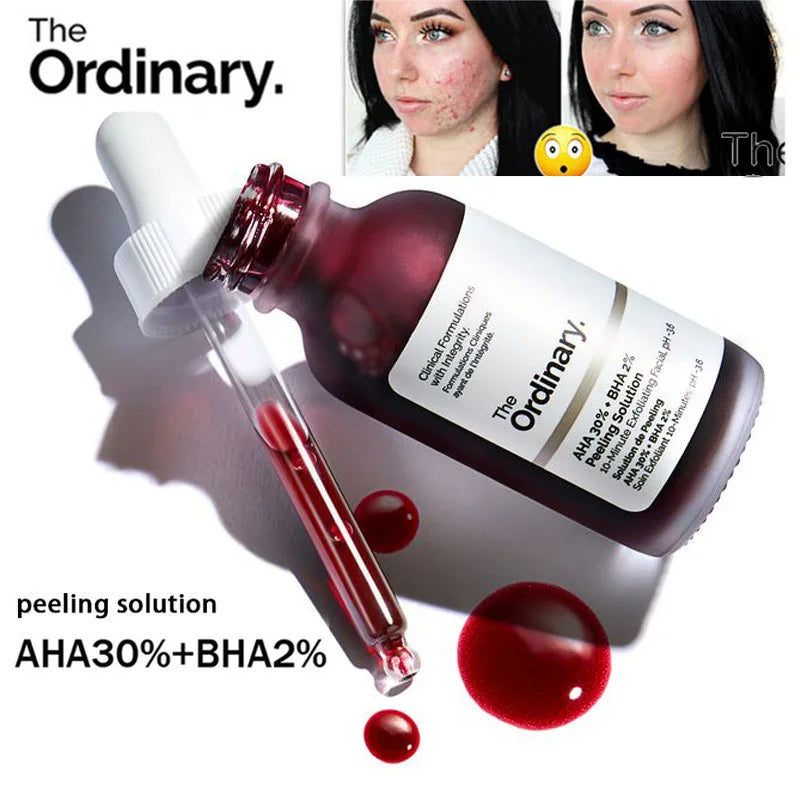 Fruit acid AHA 30% + BHA 2% exfoliating liquid facial essence salicylic acid moisturizing facial skin care products 30ml